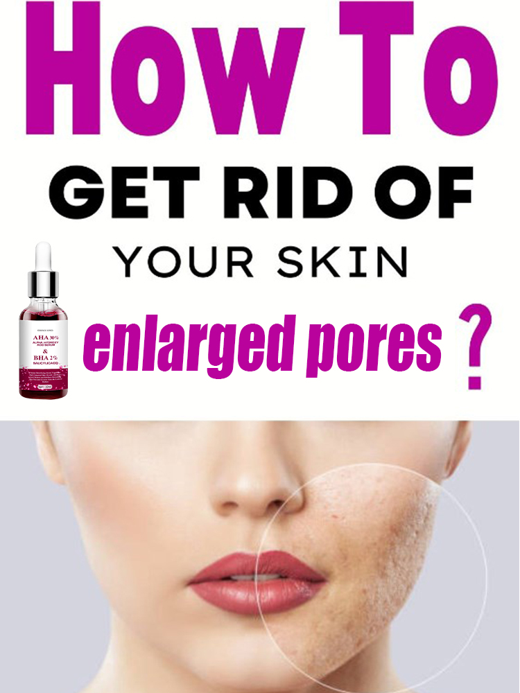 Salicylic Acid Blackhead Remover - Suero para reducir los poros, ácido