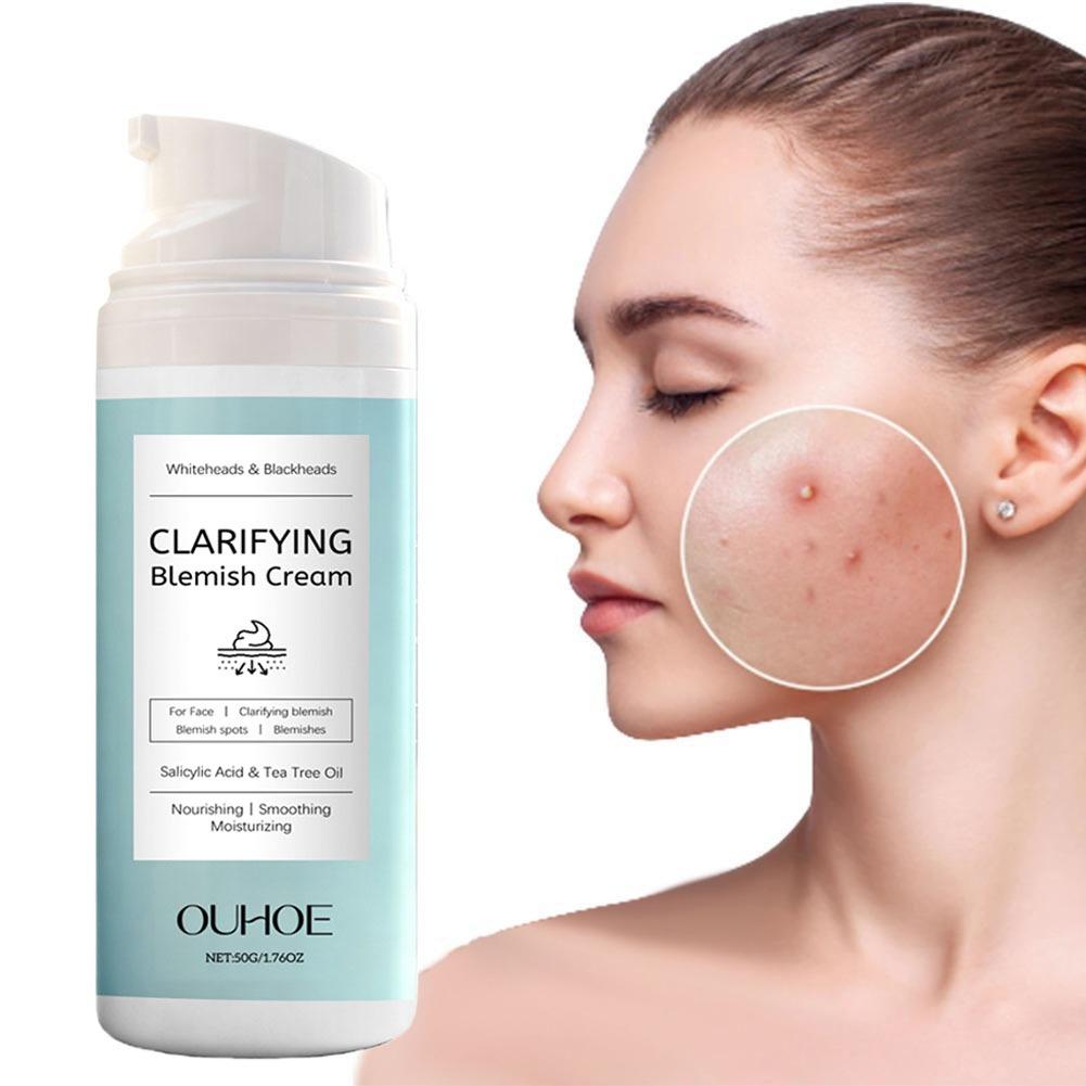 Salicylic Acid Blackhead Remover - Crema para Eliminar el Acné con