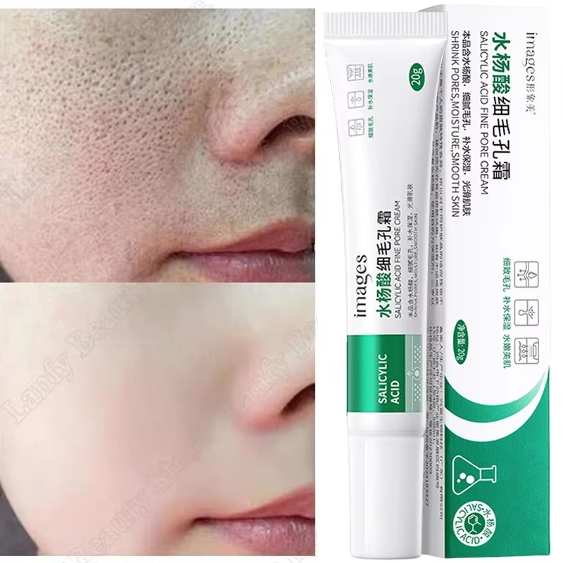 Salicylic Acid Blackhead Remover - Crema Limpiadora de Poros con Ácido