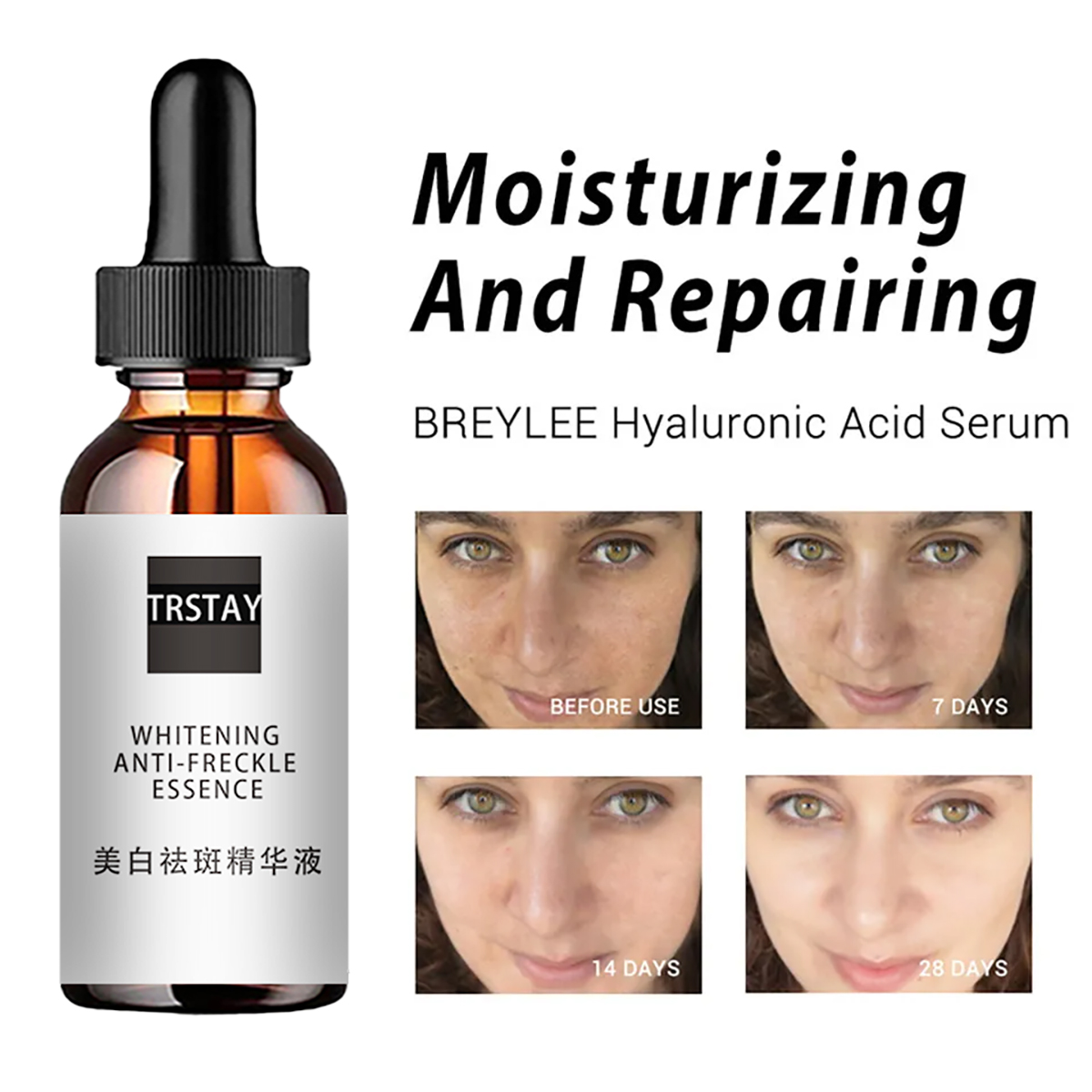 Esencias faciales con ácido de - Niacinamide Pore Shrinking Essence reseña y precio