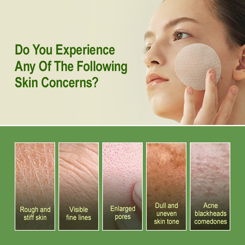 Almohadillas exfoliantes de ác - Salicylic Acid Blackhead Remover reseña y precio