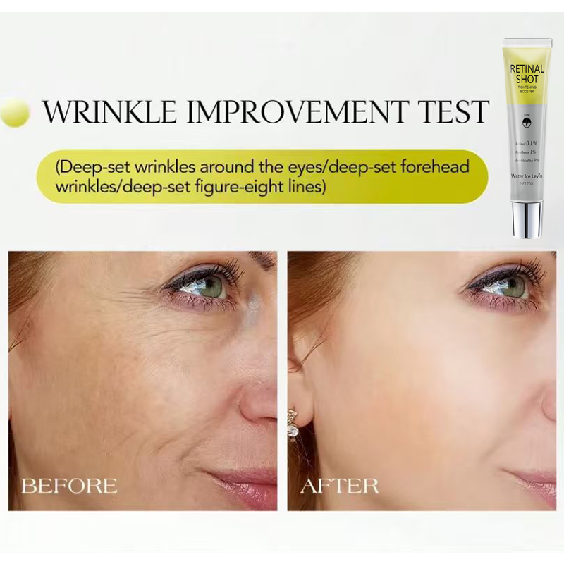 Retinal 0,1 %, tratamiento int - Retinol Anti Wrinkle Cream reseña y precio