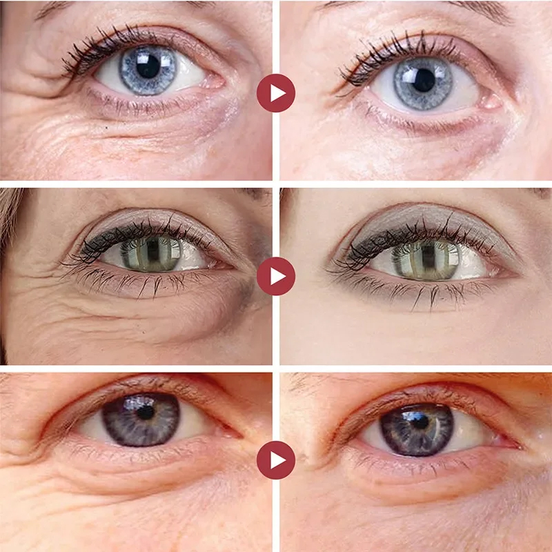 Parches para eliminar arrugas, - Collagen Under Eye Patches reseña y precio