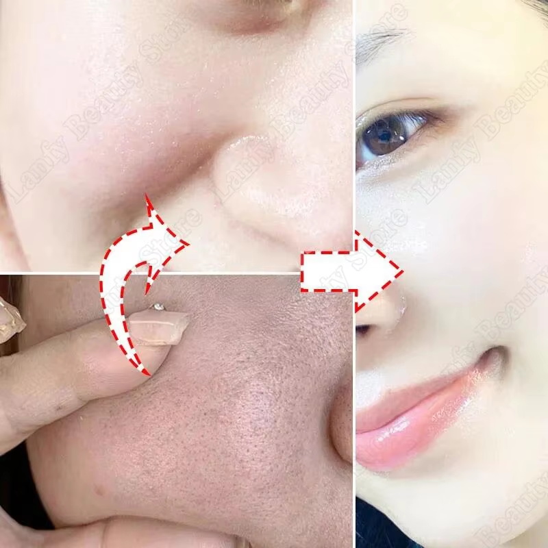 Crema Limpiadora de Poros con  - Salicylic Acid Blackhead Remover reseña y precio